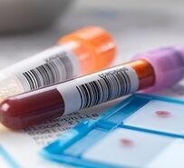 Diagnóstico de laboratorio de prostatite