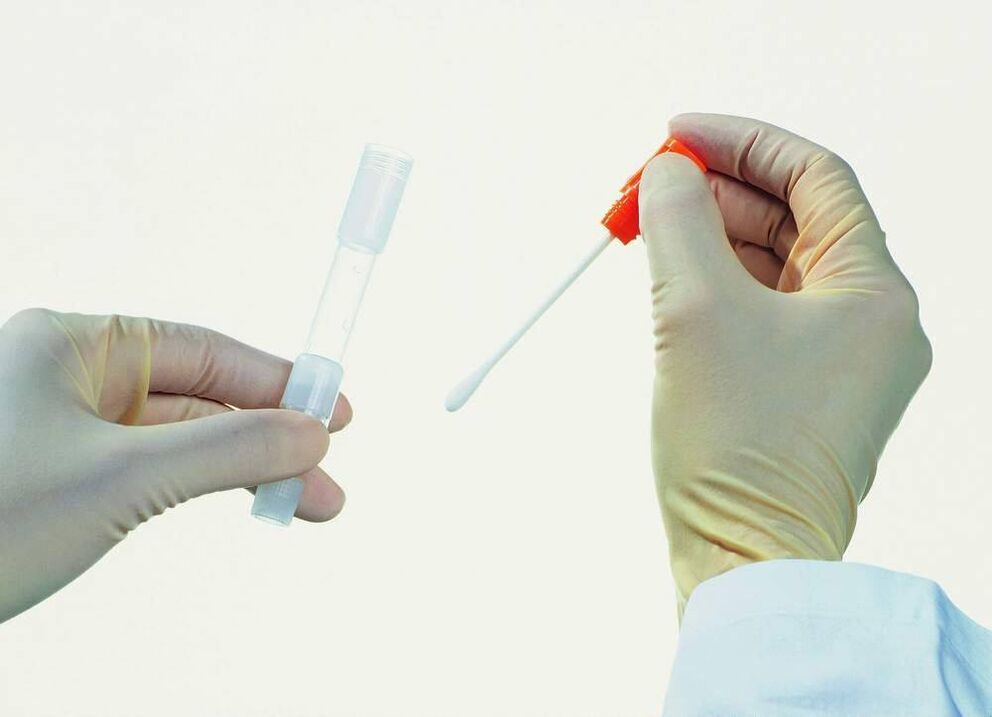 Recollida de análises para detectar prostatite crónica